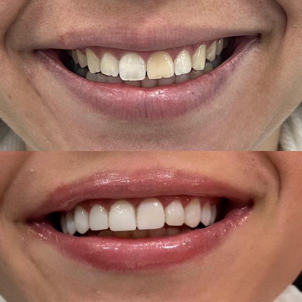 Foto 3 de Odonto Pasquarelli | Dra Maria Augusta Pasquarelli Dentista