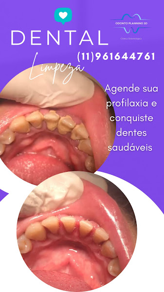 Foto 5 de Odonto Planning 3D