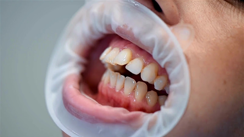 Foto 3 de Odonto Plus Aparecida