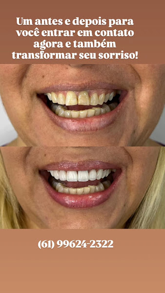 Foto 3 de Odonto Pop Dentista em Valparaíso | Implante, Tratamento de Canal e Odontopediatria