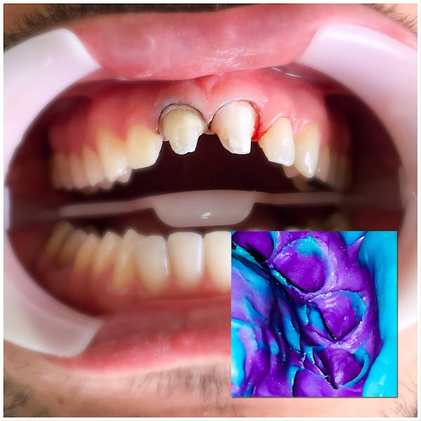 Foto 2 de Odonto Praias Marcus Mozar Cirurgião Dentista Implantodontista