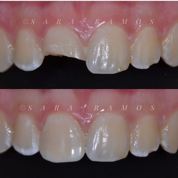 Foto 3 de Odonto Premier