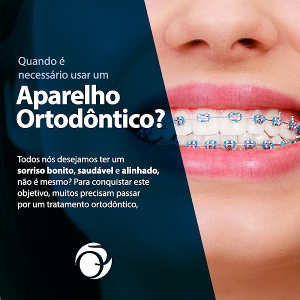 Foto 2 de Odonto Premier