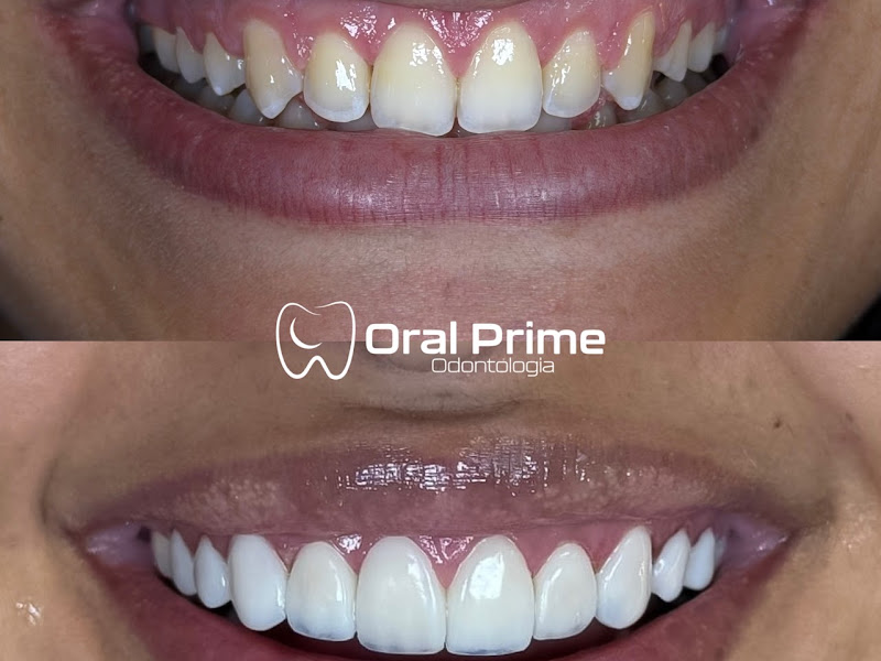 Foto 2 de Odonto Premium