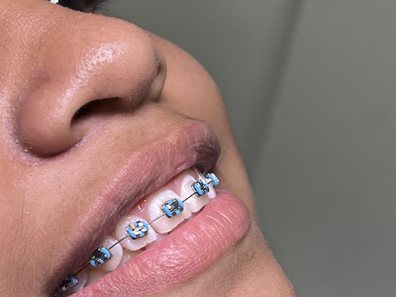 Foto 3 de Odonto Premium Caxias Ma