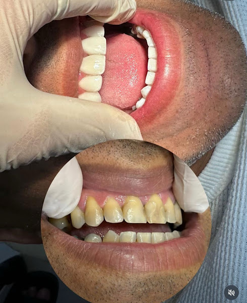 Foto 2 de Odonto Premium | Dentista em Cariacica| Implantes | Facetas