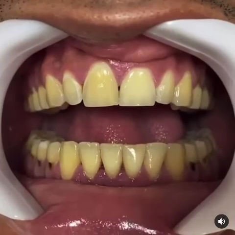 Foto 3 de Odonto Premium | Dentista em Cariacica| Implantes | Facetas