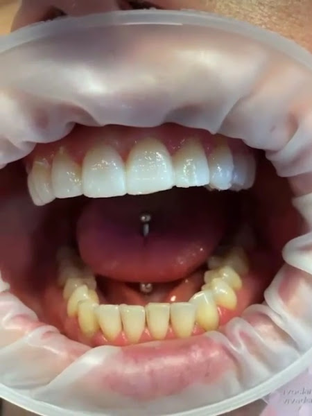 Foto 4 de Odonto Premium | Dentista em Cariacica| Implantes | Facetas