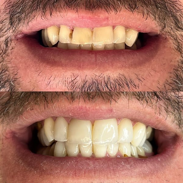 Foto 3 de Odonto Premium Imbuí