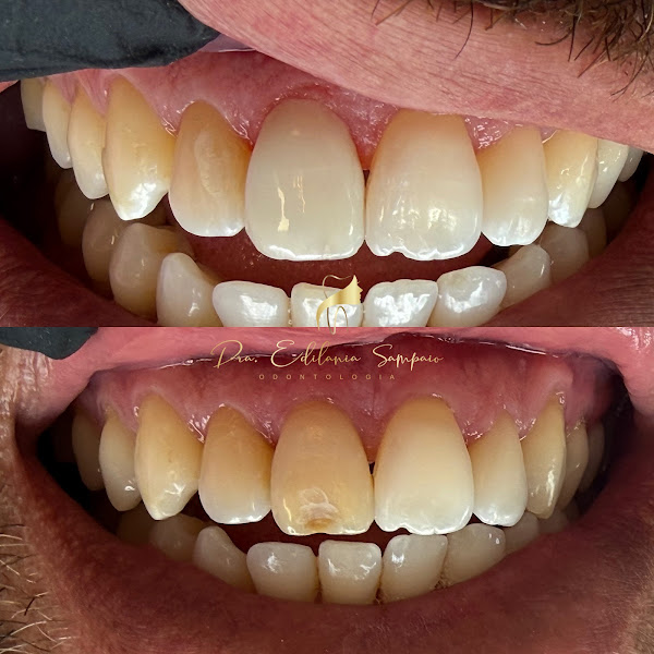 Foto 3 de Odonto Prime