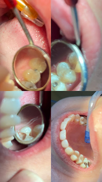Foto 3 de Odonto Prime Ptz