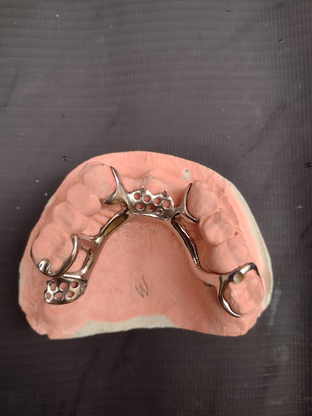 Foto 3 de Odonto Prótese