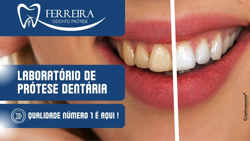 Foto 3 de Odonto Prótese Ferreira
