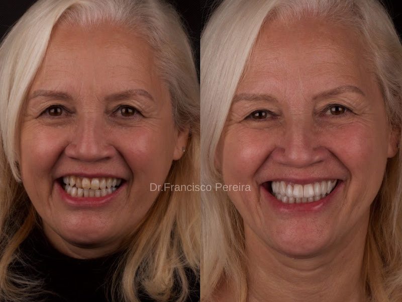 Foto 6 de Odonto Próteses Implantes