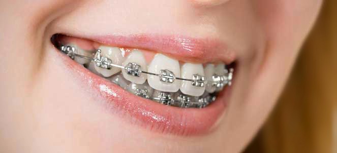 Foto 2 de Odonto Qualit