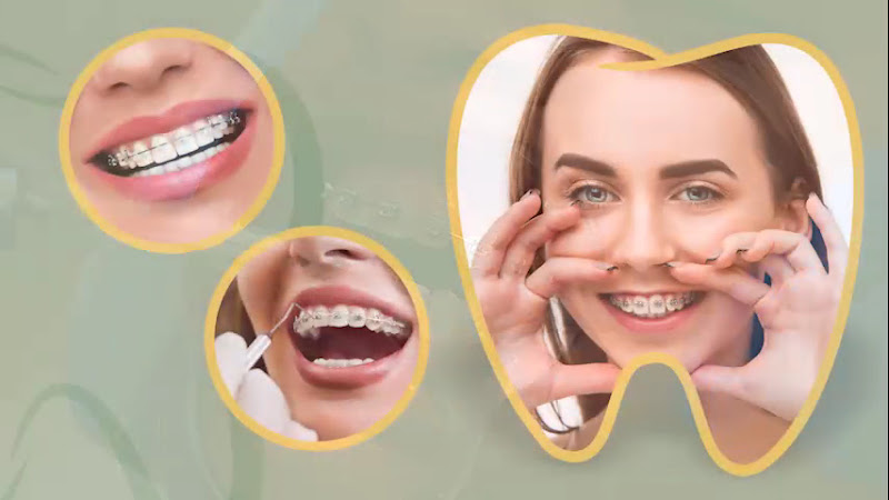 Foto 4 de Odonto Qualit