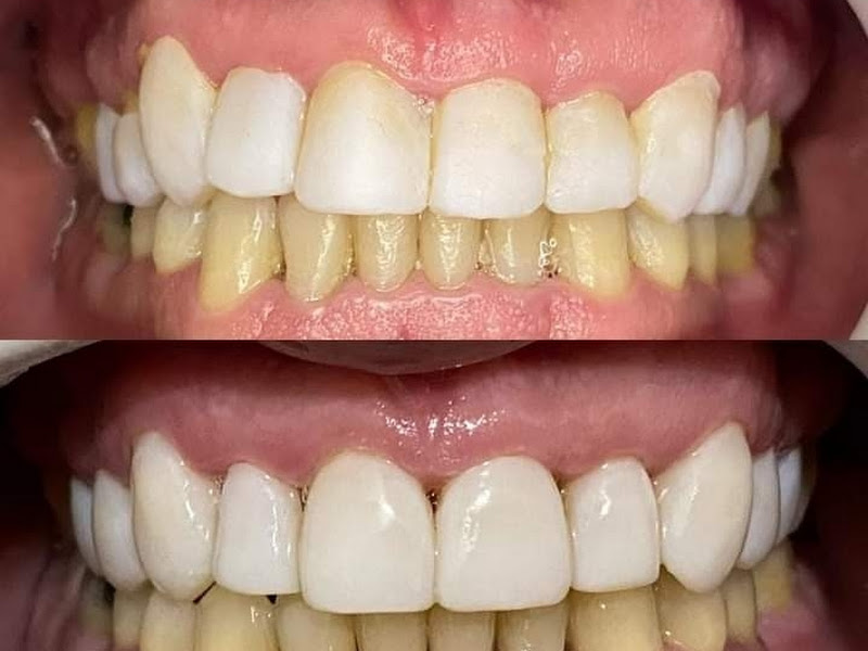 Foto 9 de Odonto Qualit