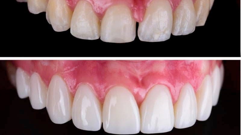 Foto 2 de Odonto QualityBH - Credenciado Sulamérica Odonto, Odontoprev, Bradesco Dental e Exames Periódicos Petrobras