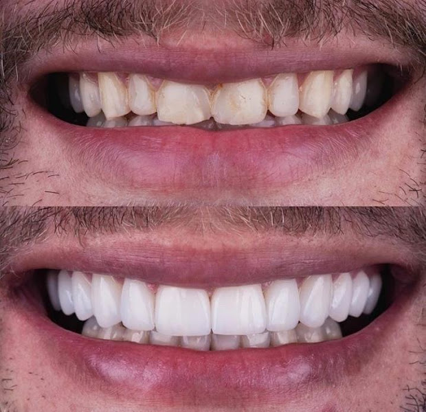 Foto 2 de Odonto Queen Consultório Odontológico