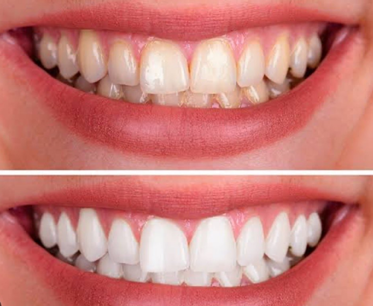 Foto 3 de Odonto Rizo