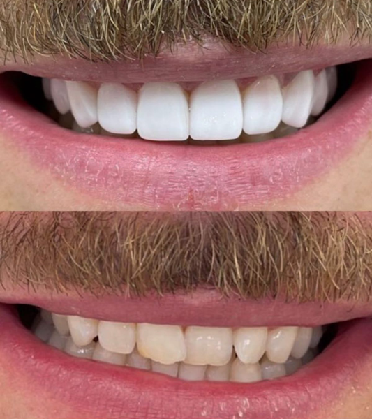 Foto 2 de Odonto Rizzo - Caxias do Sul