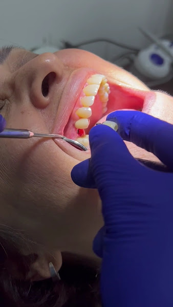 Foto 3 de Odonto Sales Cabo Frio