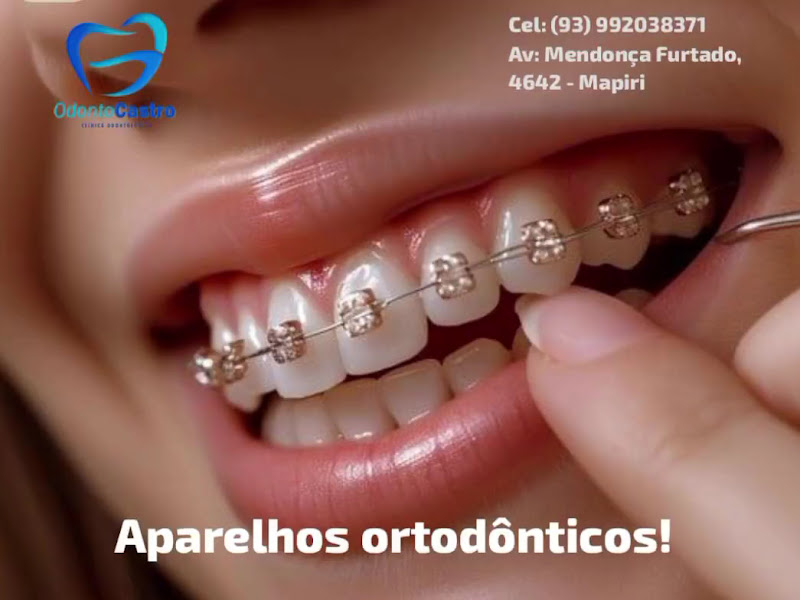 Foto 10 de ODONTO SANTARÉM