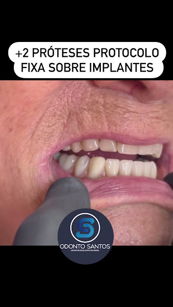 Foto 3 de Odonto Santos - Dra Kamila & Dr Vinicius