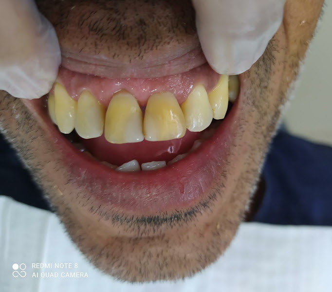 Foto 3 de Odonto Santos Rio Preto - Dentista Dra. Samara Santos - Unidade Zona Norte
