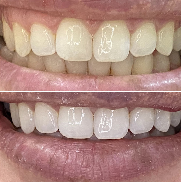 Foto 2 de Odonto & Saúde