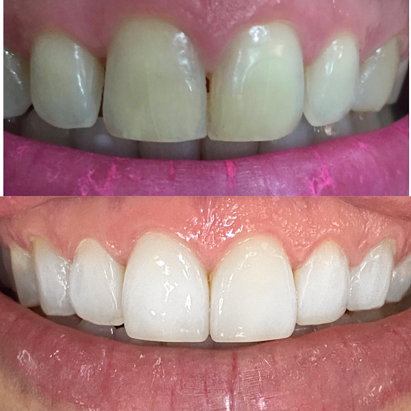 Foto 3 de Odonto & Saúde