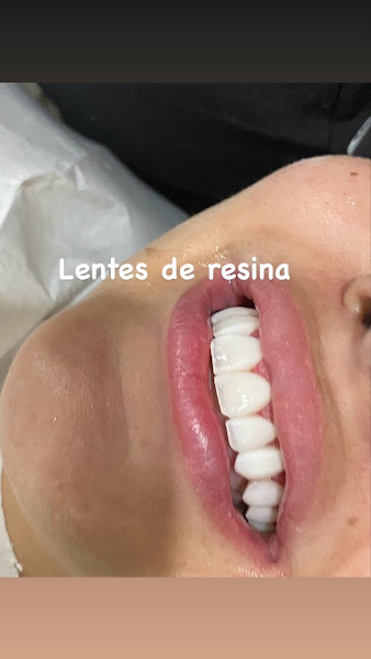 Foto 2 de Odonto Saúde & estética