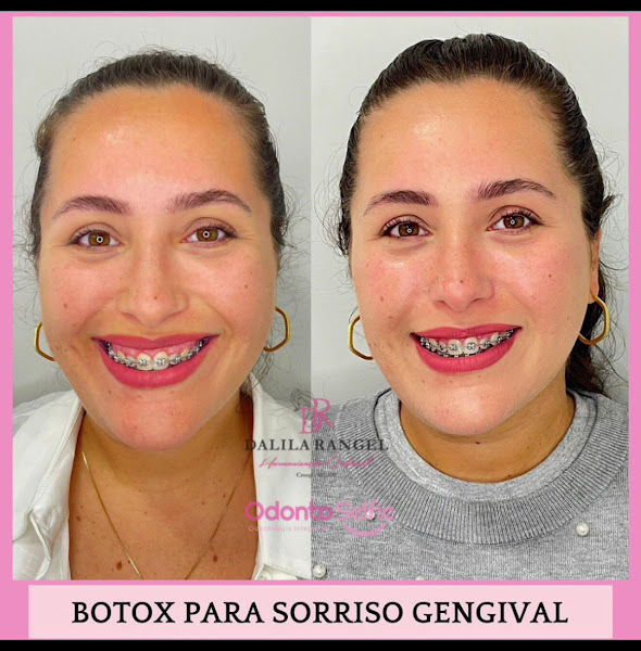 Foto 3 de Odonto Selfie - Odontologia Integrada