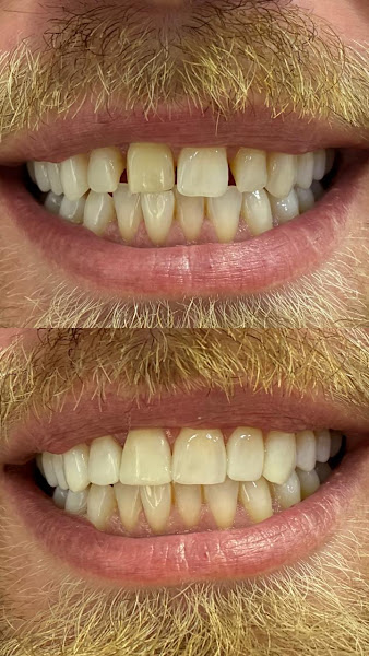 Foto 2 de Odonto Selfie Odontologia Integrada | Indaiatuba