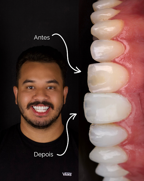 Foto 3 de Odonto sempre Clínica Odontologia - Cinco Conjuntos