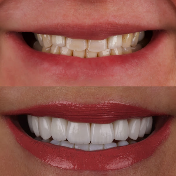 Foto 4 de Odonto sempre Clínica Odontologia - Cinco Conjuntos