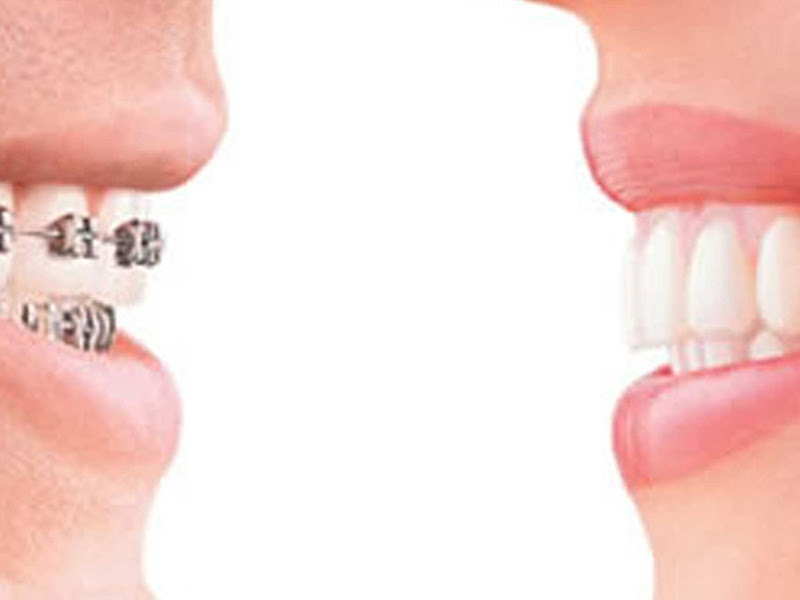 Foto 3 de Odonto Simões