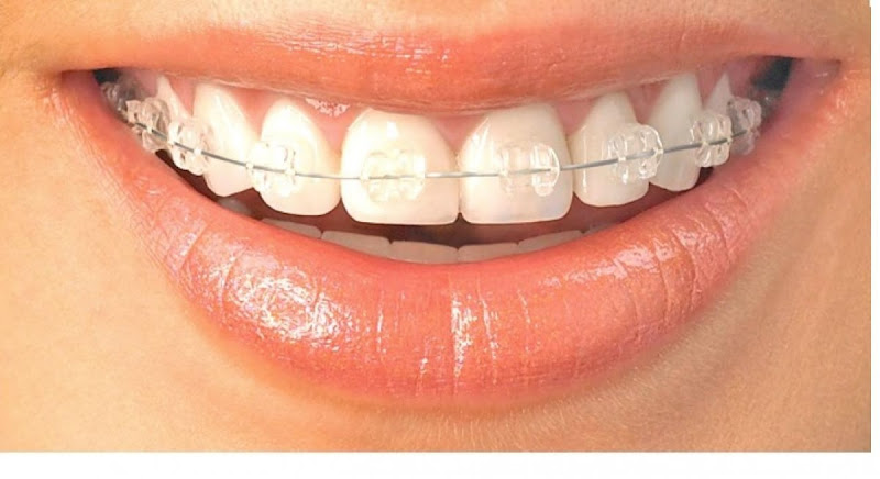 Foto 4 de Odonto Simões