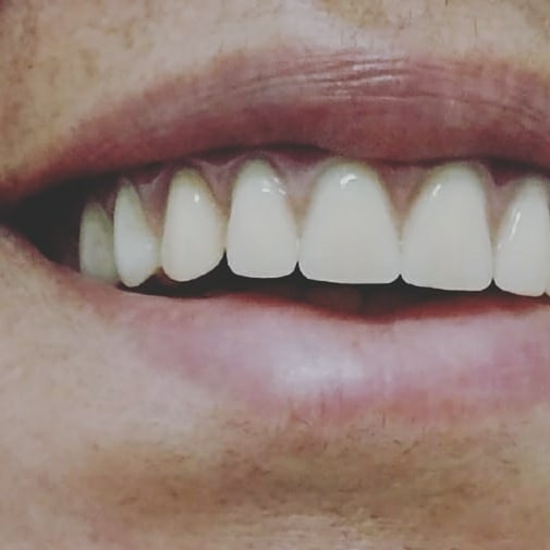 Foto 2 de Odonto Smart em Aparecida de Goiânia