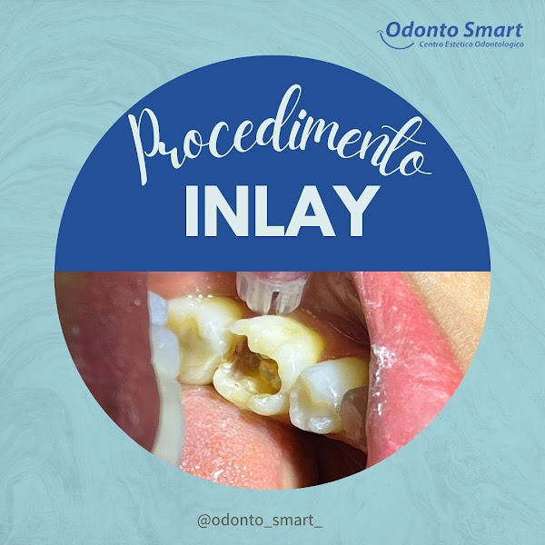 Foto 3 de Odonto Smart - Tatuapé