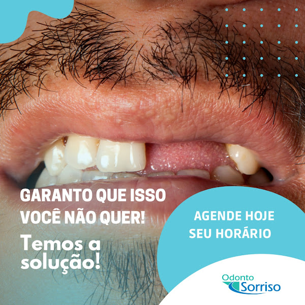 Foto 3 de Odonto Sorriso (Dr. Otávio Oliva Silva)