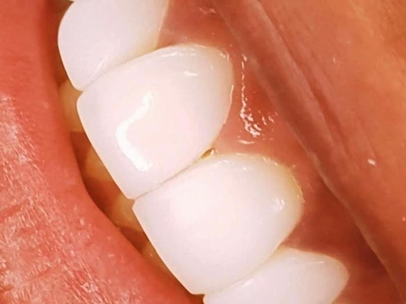 Foto 7 de Odonto SPA Capão Redondo Odontologia e Estética