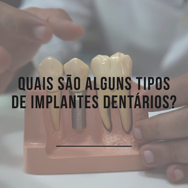 Foto 3 de Odonto Spazzio - Implante Dentário em Recife - Ortodontia - Aparelho Ortodontico em Recife - Enxertos Ósseos - Carga Imediata