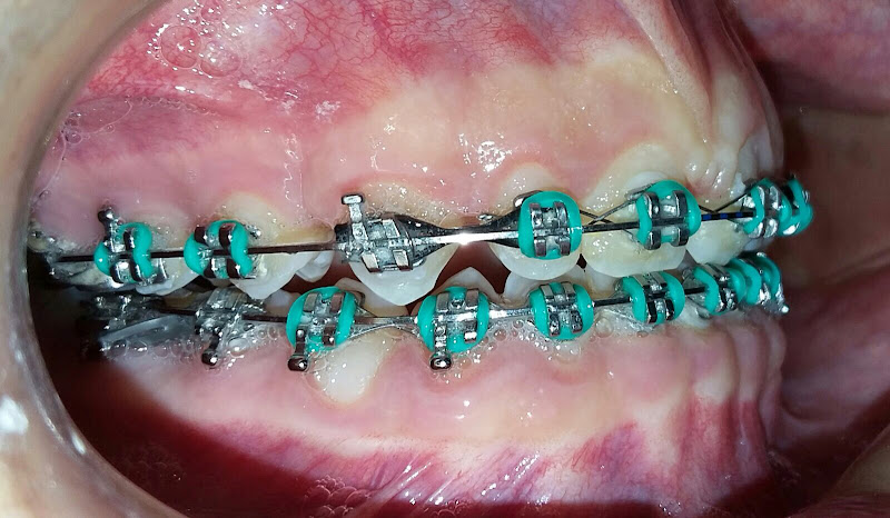 Foto 3 de Odonto Stilus