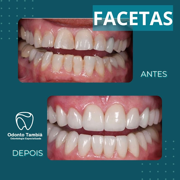 Foto 3 de Odonto Tambiá