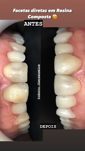 Foto 3 de Odonto Thays Ângelos