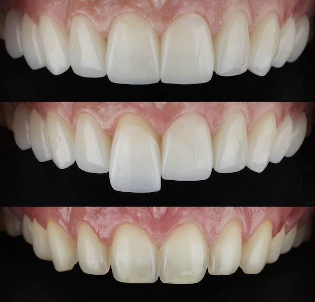 Foto 3 de Odonto vargem odontologia