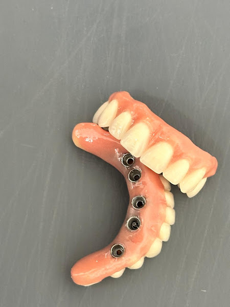 Foto 5 de Odonto Versa Tratamentos Odontológicos