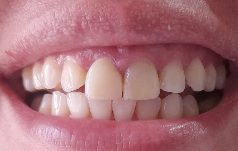 Foto 3 de ODONTO VIP