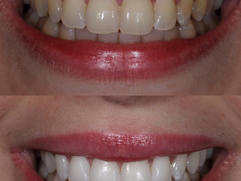 Foto 8 de Odonto Vite Aderup (Vila Nova Canaã)